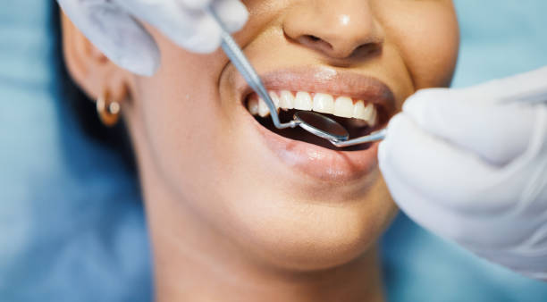 Best Emergency Gum Treatment in Clay City, KY